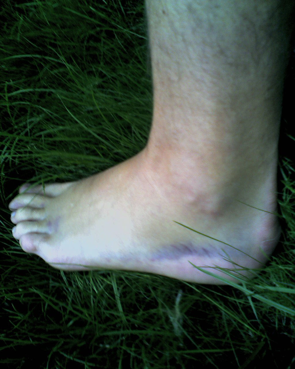 Ankle.jpg